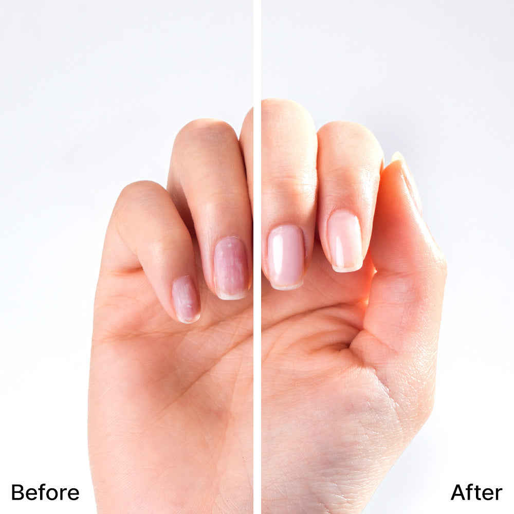 Peel-Off Base Gel